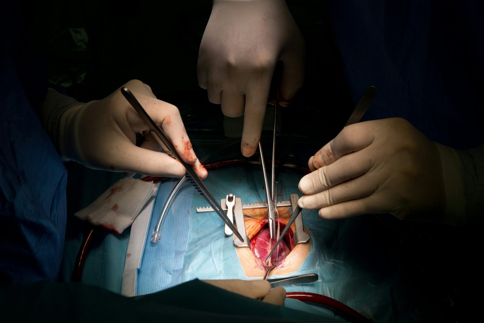 Cardiology in Bangalore advanced cardiac procedures in bangalore