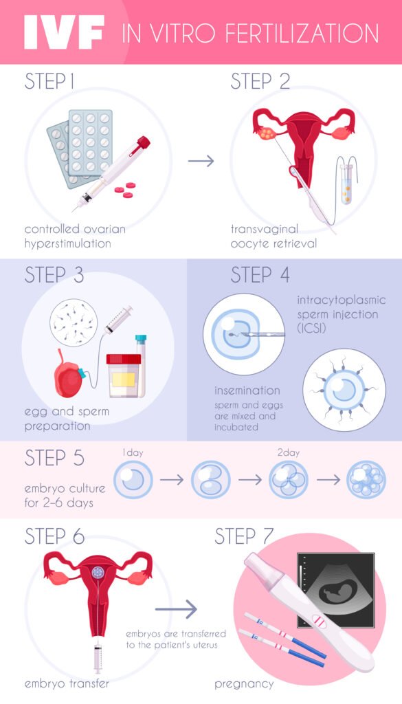 Urological & Kidney Treatment in Bangalore in vitro fertilization infographics
